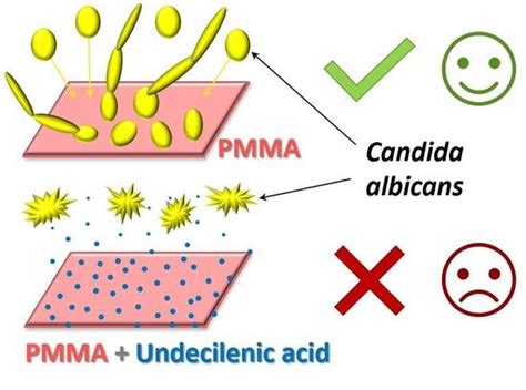 Fungicidal PMMA-Undecylenic Acid Composites