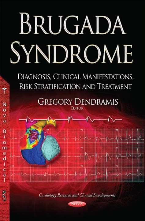 Buy Brugada Syndrome: Diagnosis, Clinical Manifestations, Risk ...