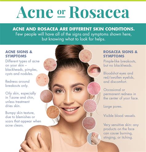 Acne OR Rosacea? The Differences Between These Skin Conditions | English Dermatology English ...