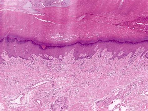 Nail Histology Characterization Of The Onychomatricodermis Containing