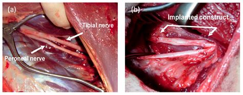 Natural Occurring Silks and Their Analogues as Materials for Nerve Conduits