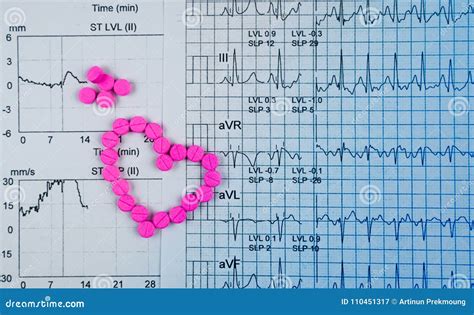 EKG Or ECG Electrocardiogram Graph Report Paper. EST Exercise Stress Test Result And Pink Heart ...