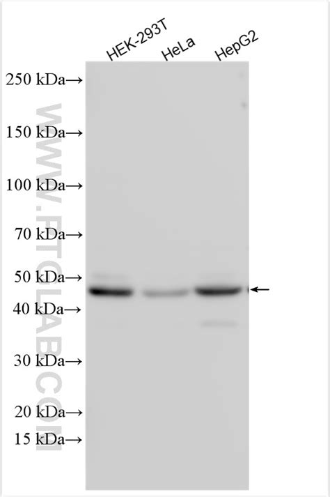 TTRAP antibody (12203-1-AP) | Proteintech