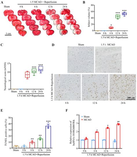 Long Non-Coding RNA 1810026B05Rik Mediates Cerebral Ischemia ...