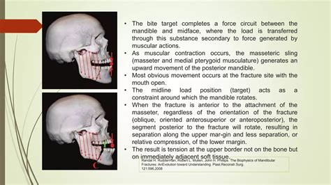Biomechanical & Basic Principles CMF Osteosynthesis.pptx