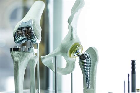 Titanium Gets Even Better with One Part Gold - Analyzing Metals