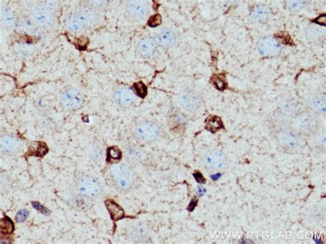 Bcl2 antibody (26593-1-AP) | Proteintech