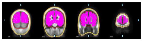 Source-Space Brain Functional Connectivity Features in ...