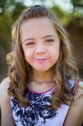 Image result for Beautiful Down Syndrome