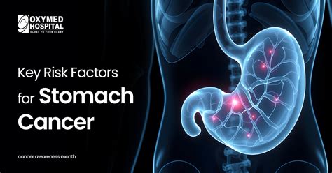 Stomach cancer | Stomach with cancer | Stomach Cancer Awareness