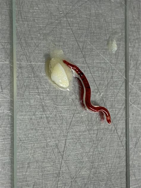 Found in the throat of a Great Black Backed Gull. The white blob is ...