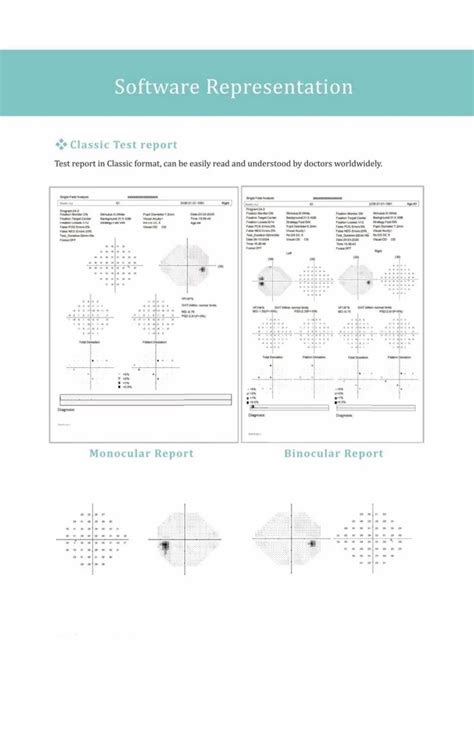Eye Testing Equipment - Eyevis Visual Field Perimeter model EP 1 Trader ...