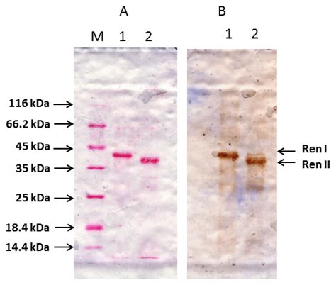 Construction of the Coding Sequence of the Transcription Variant 2 of ...