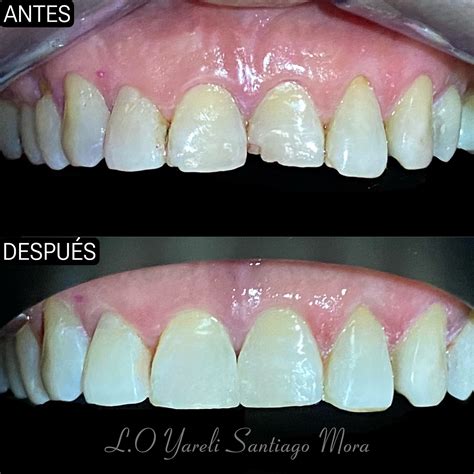 El arte de sonreir | La paciente del caso de hoy nos visito ya que ...