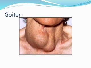 Image result for Thyroid Function Algorithm