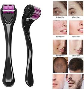 Dr. NAvadiya Derma Roller 540 Micro Needles Treating Acne Scars, Skin ...