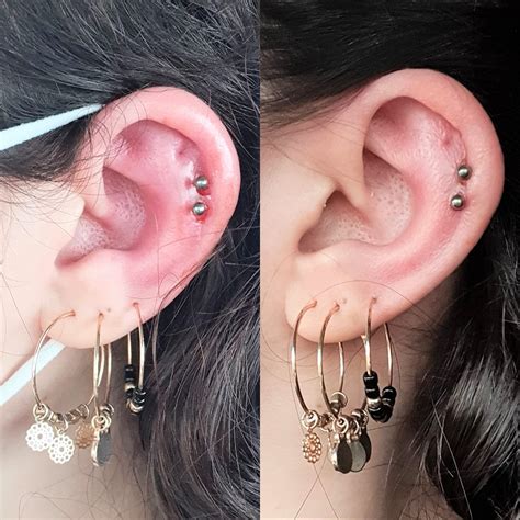 Double Helix Ear Piercing