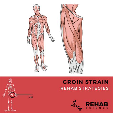 Groin Strain From Kicking at Gladys Zachery blog