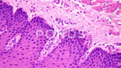 Stratified Squamous Epithelium Slide 400x