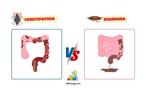 Difference Between Constipation And Diarrhea | Diffeology