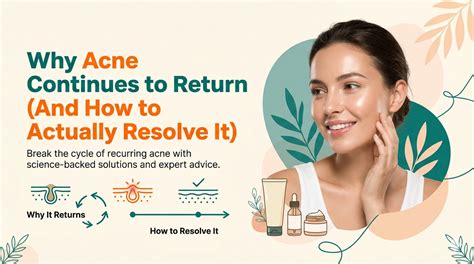 Why Acne Continues to Return (And How to Actually Resolve It) – Shop ...