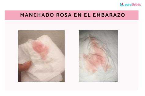 Manchado o sangrado rosa en el embarazo: 8 causas y cuándo preocuparse
