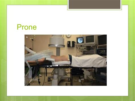 prone versus supine pcnl | PPTX