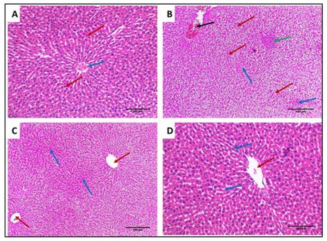 Anti-Biofilm and Antibacterial Activities of Cycas media R. Br ...