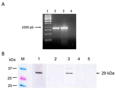 Spherical Body Protein 4 from Babesia bigemina: A Novel Gene That ...