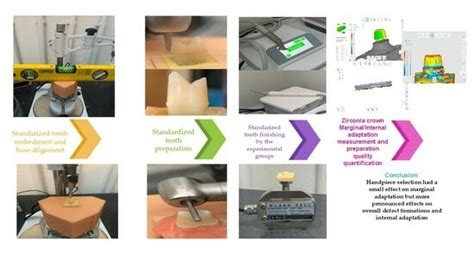 In Vitro Comparison of Monolithic Zirconia Crowns: Marginal/Internal ...