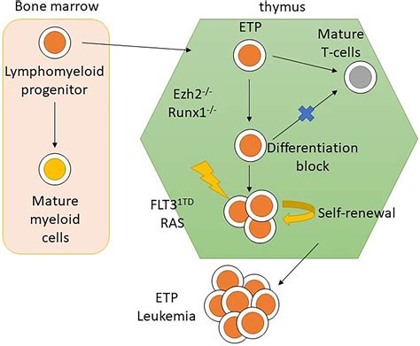 T Cell Acute Lymphoblastic Lymphoma