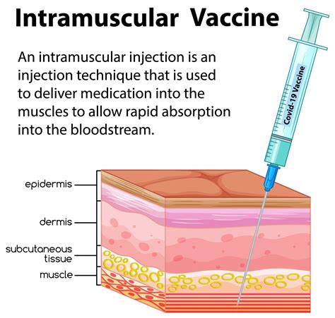 Information vector on intramuscular injection 1542647 Vector Art at ...