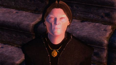 Oblivion Ps3 Vampire Cure