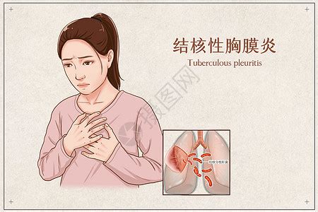 呼吸疾病图片_呼吸疾病素材_呼吸疾病高清图片_摄图网图片下载_第2页