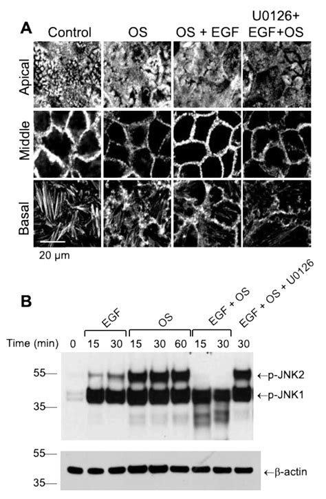 Lactobacillus casei and Epidermal Growth Factor Prevent Osmotic Stress ...