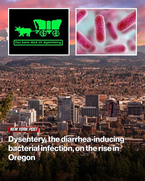 New York Post | Dying of dysentery is now more than just a video game ...