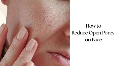 How to Reduce Open Pores on Face Naturally & Permanently