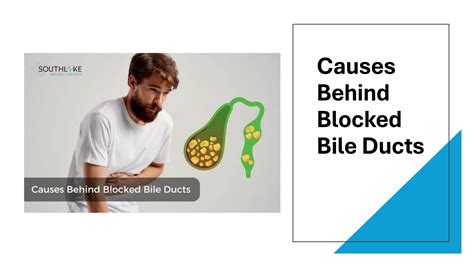 Understanding Blocked Bile Duct Symptoms.pdf