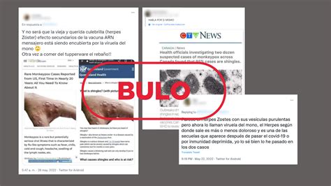 La viruela del mono no es un herpes con el nombre cambiado
