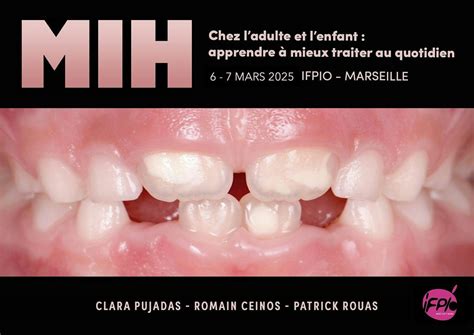 MIH CHEZ L’ADULTE ET L’ENFANT Apprendre à mieux la traiter au quotidien ...