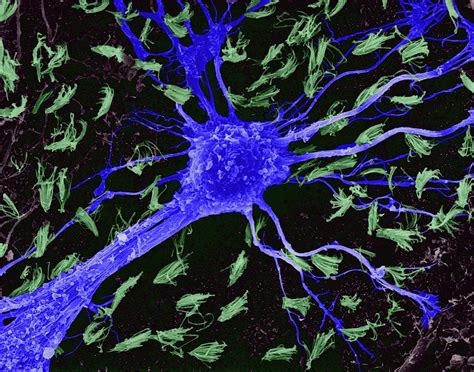 astrocytic glial cell from cns photograph by dennis kunkel