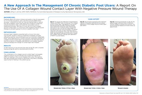 Nice 2014 Pressure Ulcers