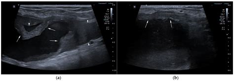 Computed Tomographic and Ultrasonographic Features in Three Dogs with ...