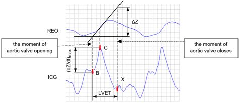 A New Method of Identifying Characteristic Points in the Impedance ...
