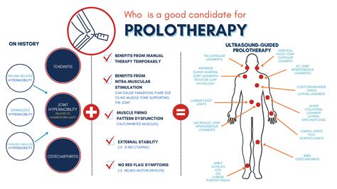 What Is Prolotherapy