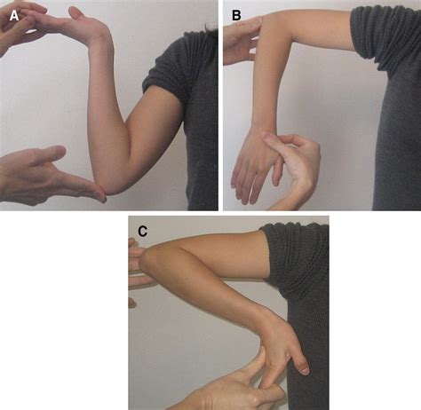 Shoulder internal rotation elbow flexion test for diagnosing cubital ...