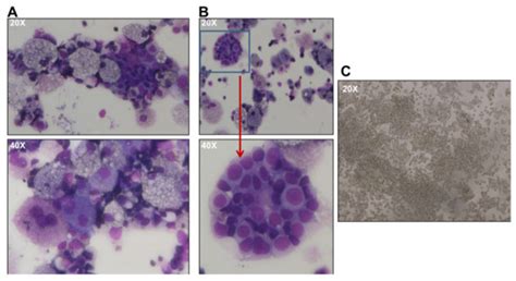 Modeling Global Genomic Instability in Chronic Myeloid Leukemia (CML ...