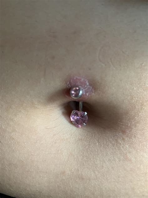 How To Heal A Belly Button Piercing Infection - Tankbell22