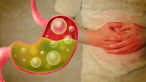 Acid reflux: Meaning, causes, symptoms, remedies, and treatment