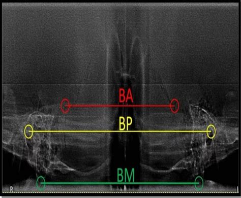 Innovative techniques in Oral & Maxillofacial Radiology|SDCINDIA